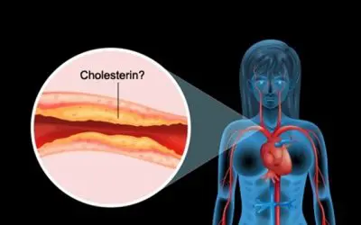 Die Cholesterin-Lüge: Natürliche Grenzwerte von Cholesterin